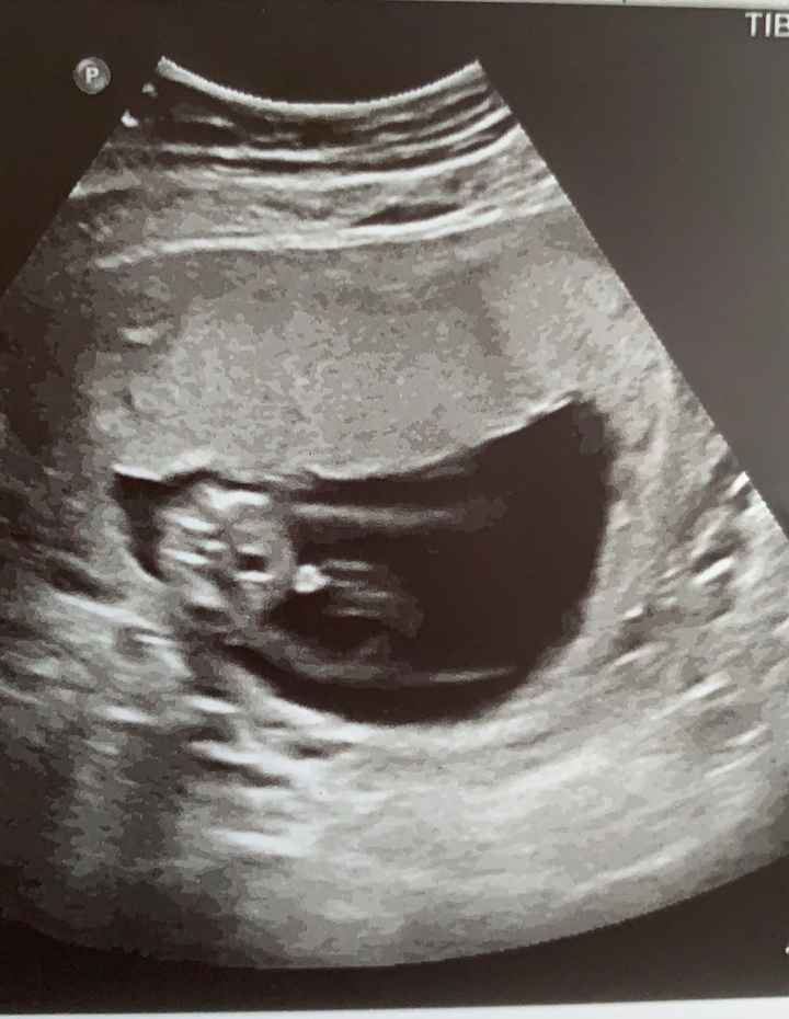 Maschio 💯 % ??? - 1