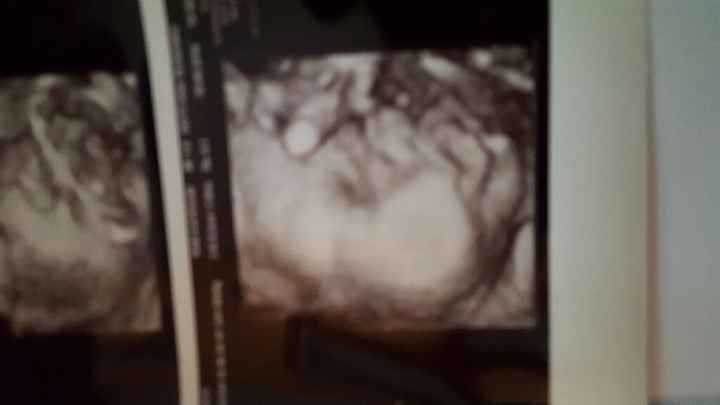 38 settimane e ultima eco... - 2