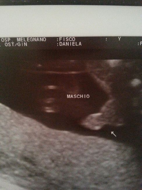 La visita più bella fino ad oggi..la morfologica? - 2