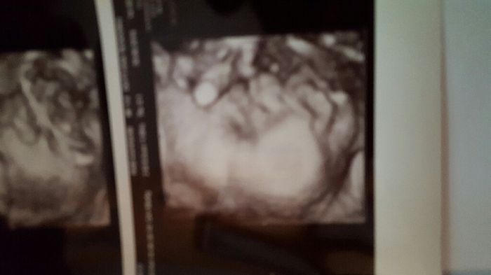 38 settimane e ultima eco... - 2