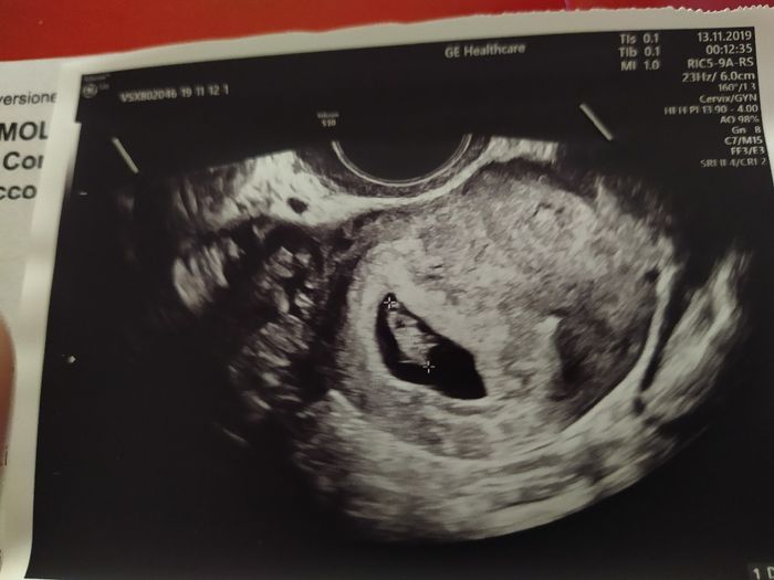 Future Mamme Giugno 2020 - 1