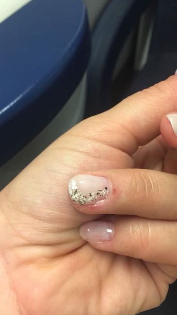 Problema estetista ed unghie! 2