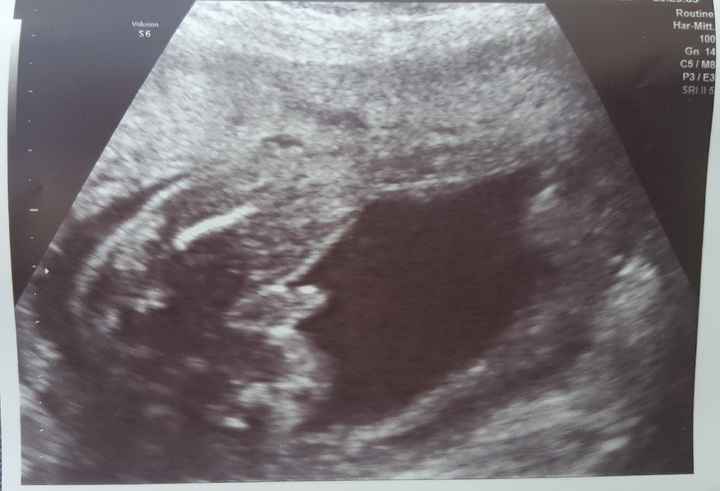 Dubbio morfologica e sesso - 1