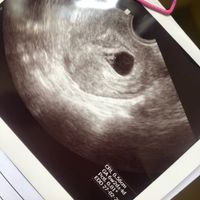 Non sono incinta ma devo fare la Beta... - 1