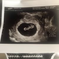 Maschietto o femminuccia? - 1