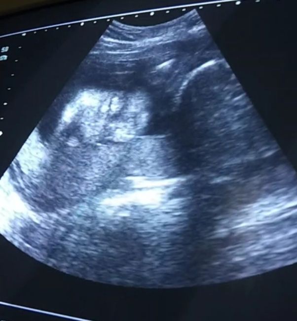 Future mamme Aprile 2022 - 1