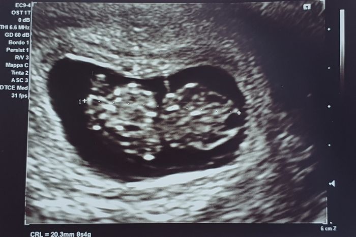 Future mamme Aprile 2022 - 1