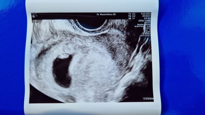 Future Mamme Ottobre 2024 🍀🌈🍁🌸 - 1