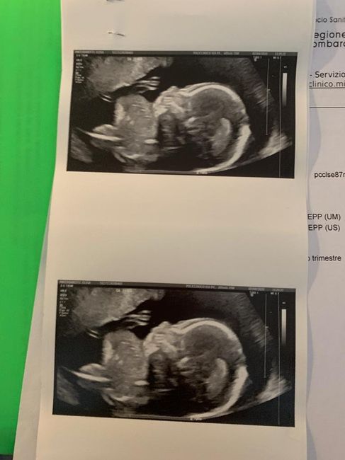 Mamme di Agosto 2020😍🤞😍 - 2