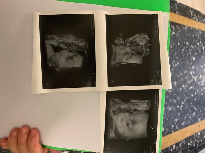 Mamme di Agosto 2020😍🤞😍 - 1