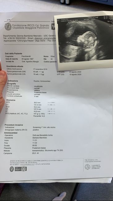 Femore 24 settimane 3