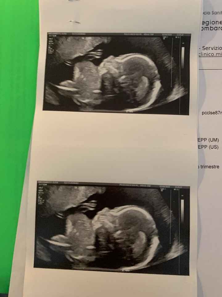 Mamme di Agosto 2020😍🤞😍 3