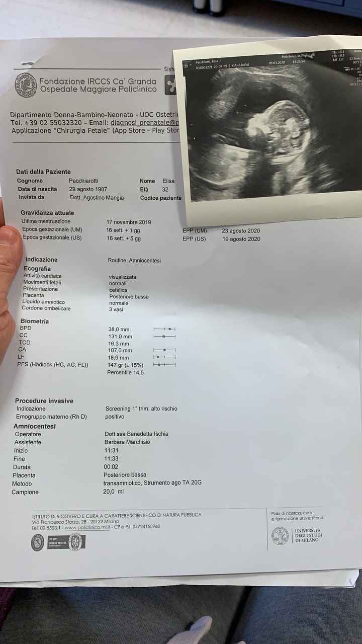 Femore 24 settimane - 1