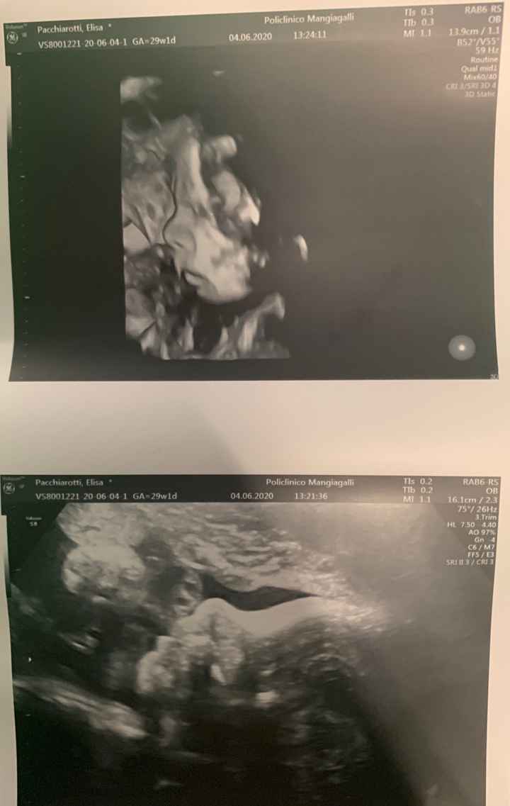 Mamme di Agosto 2020😍🤞😍 - 1