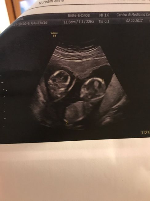  a 6+3...semini pulsanti! - 1