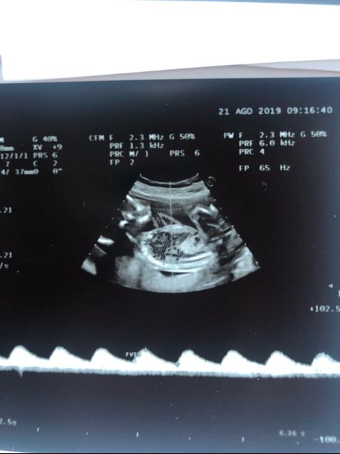 Mamme di Gennaio 2020 ❤️ - 1