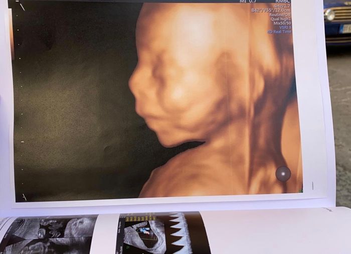 Future mamme novembre 2020 🌞🍁🌷♾ - 1