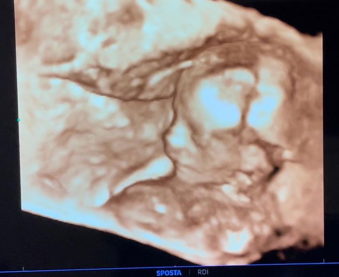 Future mamme ottobre 2022 - 1