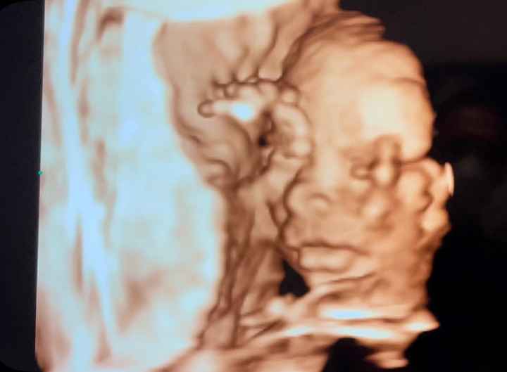 Future mamme ottobre 2022 - 1