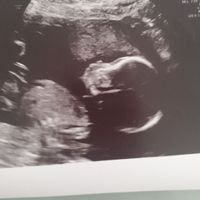 Future mamme ottobre 2020 - 1