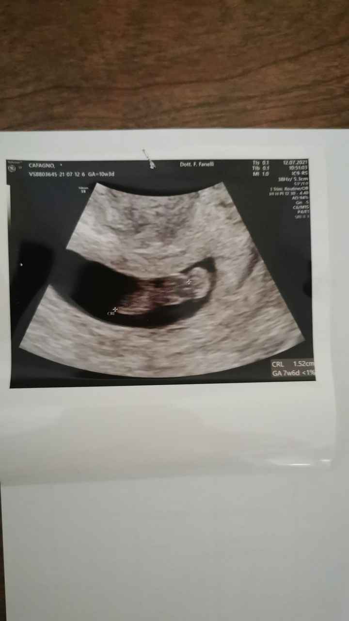 ecco il mio fagiolino 😍😍 - 1