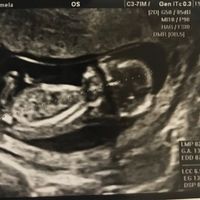 Esperte Nub Theory - 1