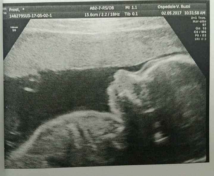 Mamme settembre 2017 - 1