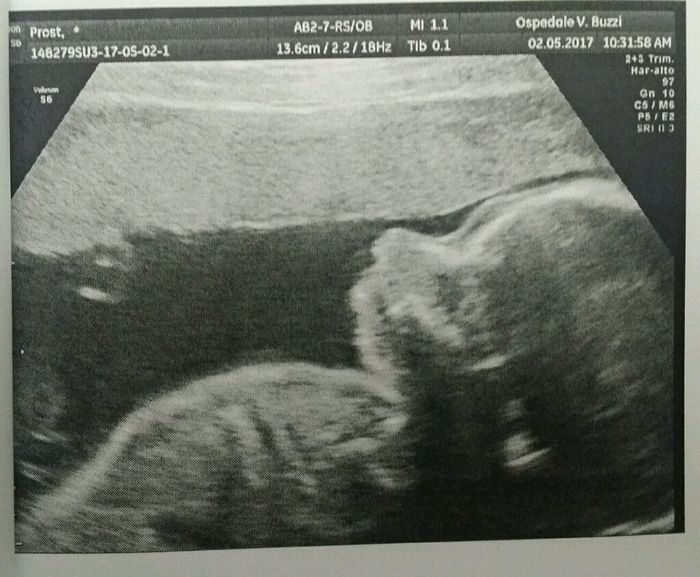 Mamme settembre 2017 - 1