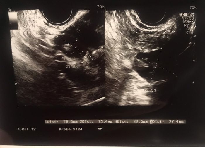 Chi non le aspetta per Giugno 2022 🌻🤰🏻♥️ 2