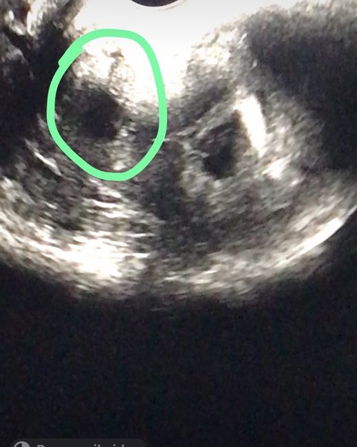 Future mamme febbraio 2023 🍀🙏🏻 3