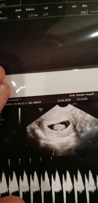 Metodo Ramzi... mi aiutate? 4