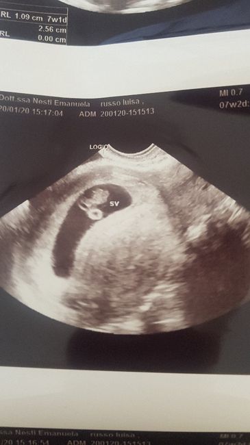 Metodo Ramzi! Chi ci sa azzeccare? 4