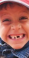 Sorriso Durbans!