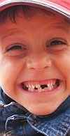 Sorriso Durbans!