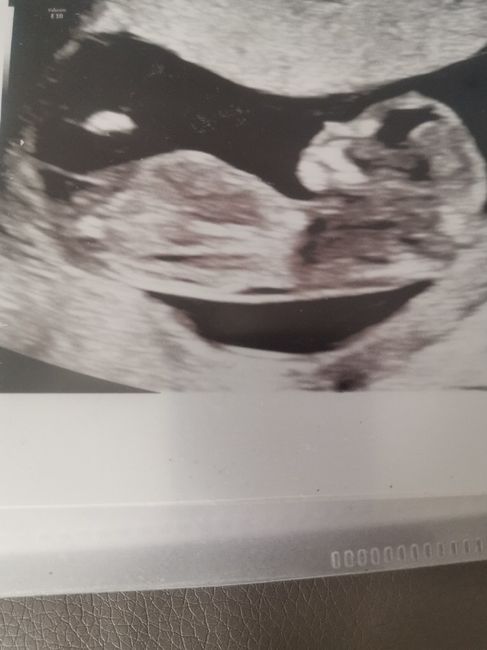 Maschietto o femminuccia?? 2