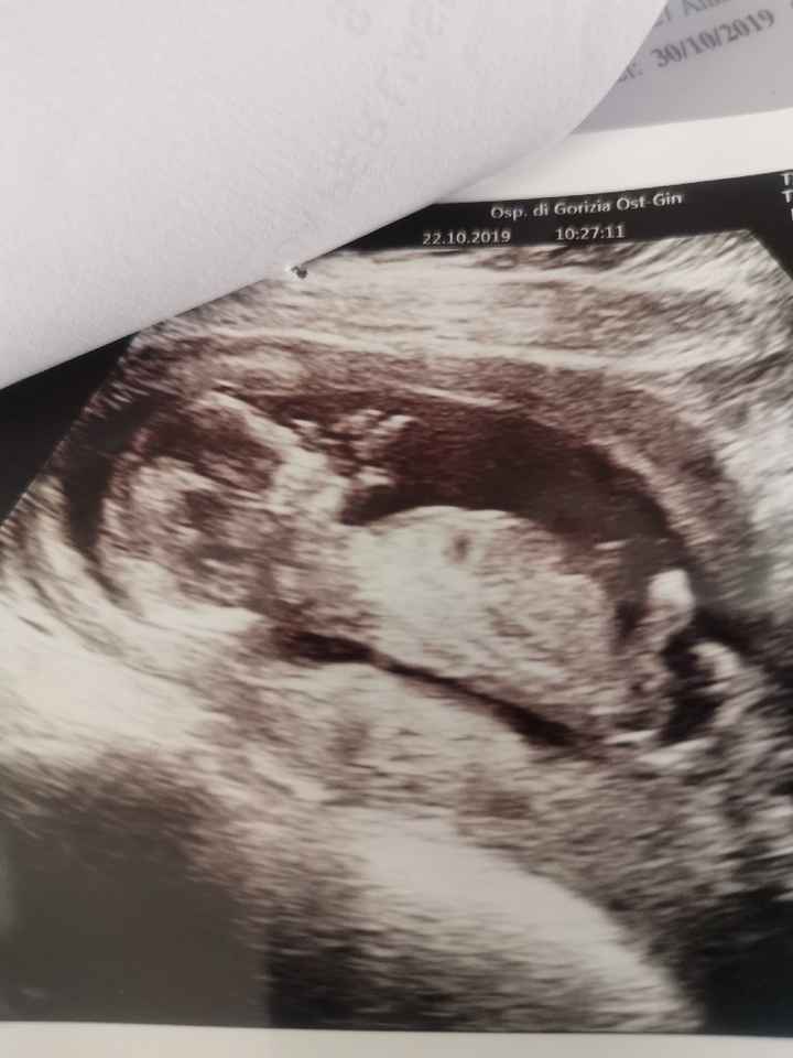 Maschietto o femminuccia?? - 1