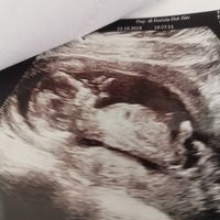 Maschietto o femminuccia?? - 1