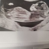 Maschietto o femminuccia?? - 2