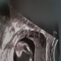 Ecografia,. Maschio o femmina? - 1