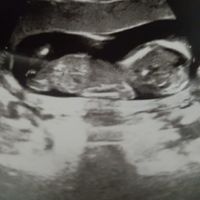 Ecografia,. Maschio o femmina? - 2