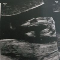 Ecografia,. Maschio o femmina? - 3