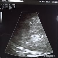 Aspiranti mamme di Novembre 2018!!!🍀 - 1