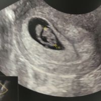 Due domandine 😜 - 1