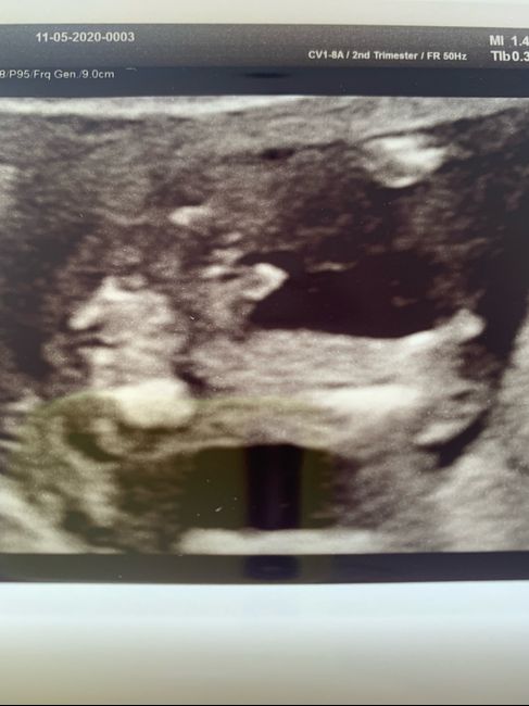 Future mamme novembre 2020 🌞🍁🌷♾ - 1