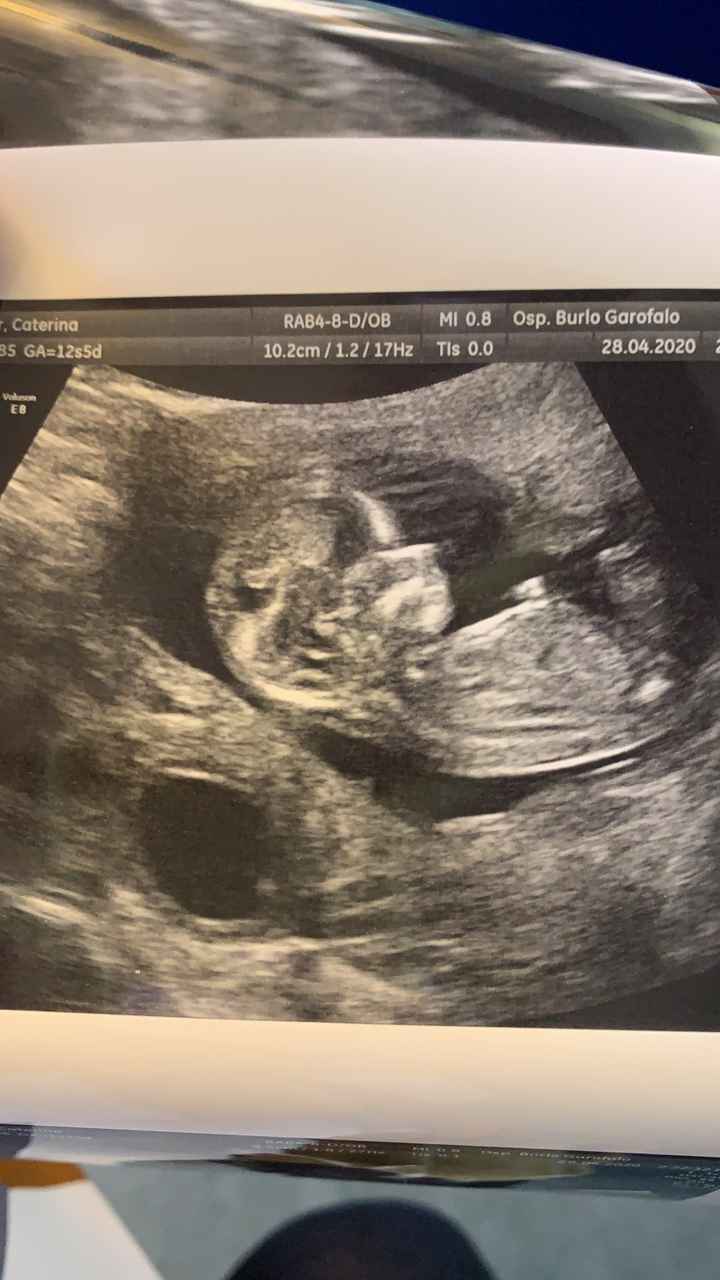 Future mamme novembre 2020 🌞🍁🌷♾ - 1