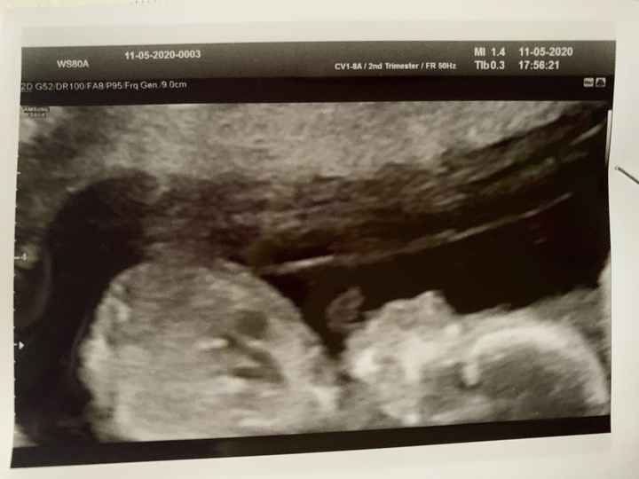 Future mamme novembre 2020 🌞🍁🌷♾ - 1