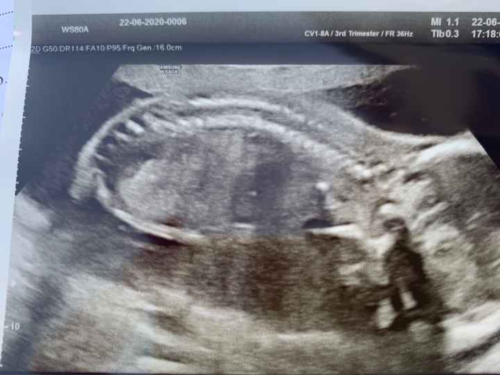 Future mamme novembre 2020 🌞🍁🌷♾ - 2