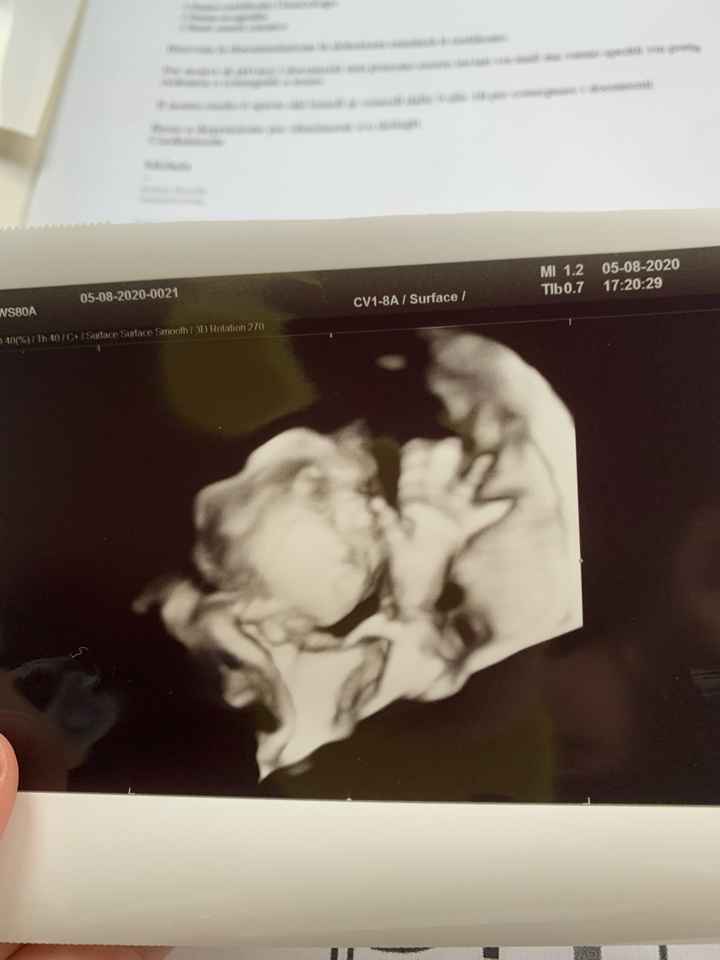 Future mamme novembre 2020 🌞🍁🌷♾ - 1