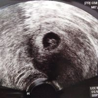 Future mamme Marzo 2021 - 1