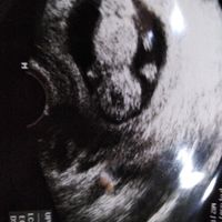 Future mamme Marzo 2021 - 1